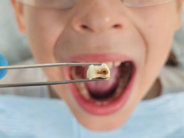 Best Tooth Pain Emergency Relief  in Warrenvle, IL
